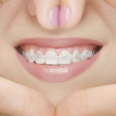 ortodoncia-la-sonrisa-que-deseas