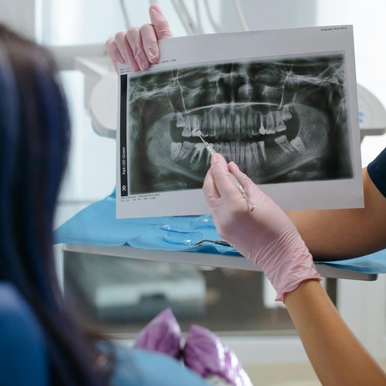 iodof - odontologia